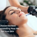 Choose the Best Microneedling Near Me for Your Skin