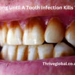 How Long Until A Tooth Infection Kills You