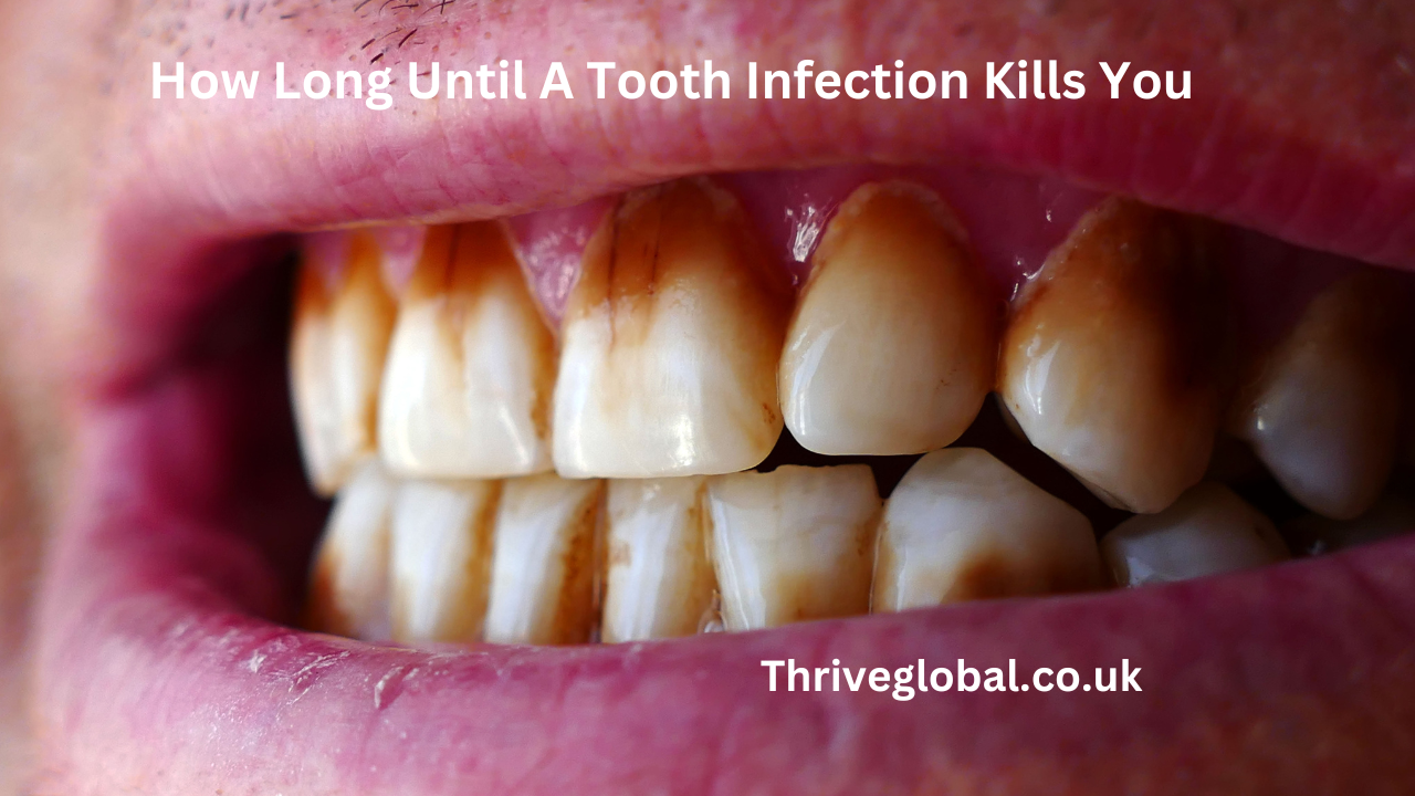 How Long Until A Tooth Infection Kills You