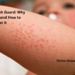 Rash from Rash Guard Why It Happens and How to Treat It