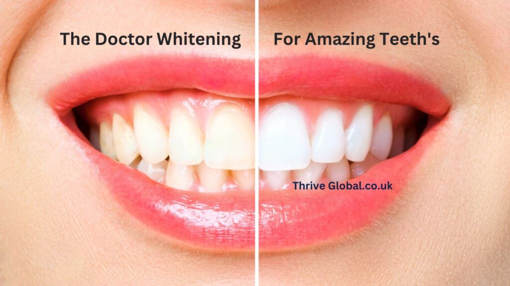 The Doctor Whitening For Amazing Teeths