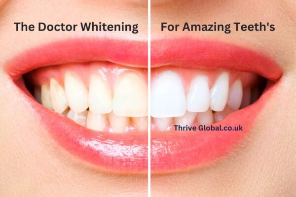 The Doctor Whitening For Amazing Teeths