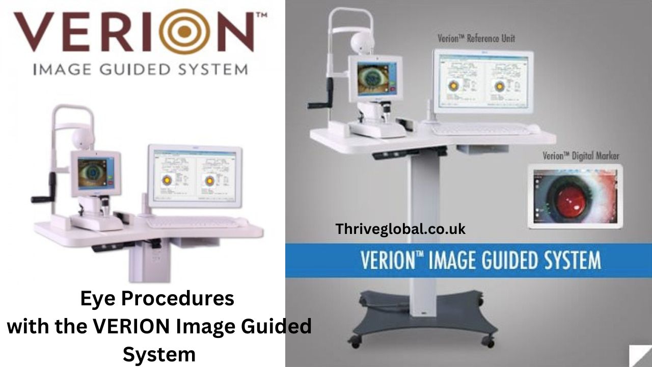 Discover how the VERION Image Guided System revolutionizes eye procedures with computer-assisted customization for enhanced surgical precision and outcomes.